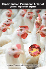 Hipertensión Pulmonar Arterial - Norma Elizabeth Domínguez Avila