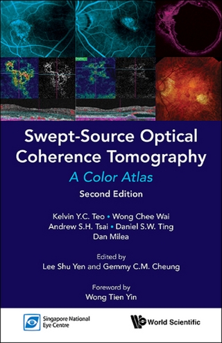 SWEPT-SOURCE OPTIC COHE (2ND ED)
