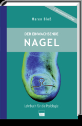 Der einwachsende Nagel - Maren Blo&szlig;