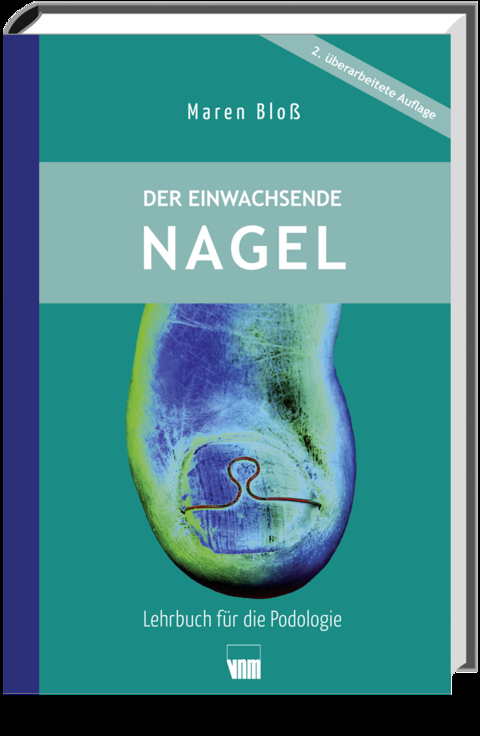 Der einwachsende Nagel - Maren Blo&szlig;