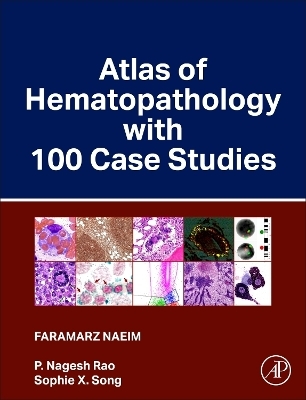 Atlas of Hematopathology with 100 Case Studies - Faramarz Naeim, P. Nagesh Rao, Sophie X. Song