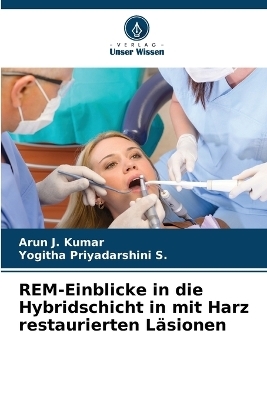 REM-Einblicke in die Hybridschicht in mit Harz restaurierten Läsionen