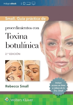 Small. Gu&iacute;a pr&aacute;ctica de procedimientos con toxina botul&iacute;nica - Rebecca Small