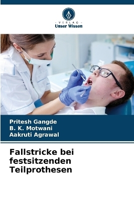 Fallstricke bei festsitzenden Teilprothesen - Pritesh Gangde, B K Motwani, Aakruti Agrawal