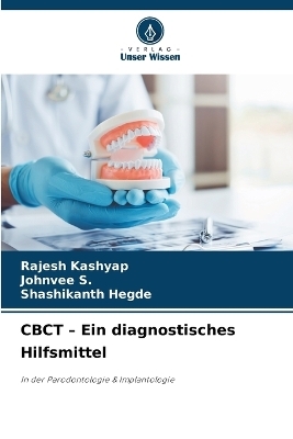 CBCT - Ein diagnostisches Hilfsmittel - Rajesh Kashyap, Johnvee S, Shashikanth Hegde