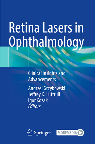 Retina Lasers in Ophthalmology