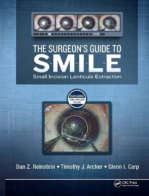 The Surgeon&rsquo;s Guide to SMILE - Dan Reinstein, Timothy Archer, Glenn Carp