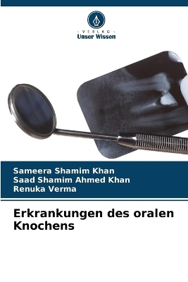 Erkrankungen des oralen Knochens - Sameera Shamim Khan, Saad Shamim Ahmed Khan, Renuka Verma
