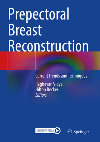 Prepectoral Breast Reconstruction