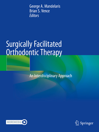 Surgically Facilitated Orthodontic Therapy