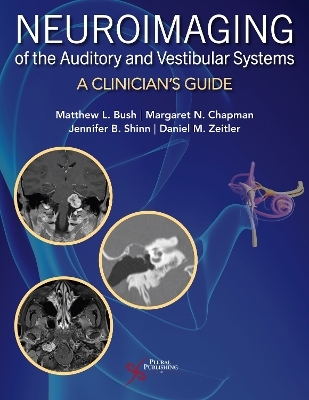 Neuroimaging of the Auditory and Vestibular Systems - Matthew L. Bush, Margaret N. Chapman, Jennifer B. Shinn, Daniel M. Zeitler