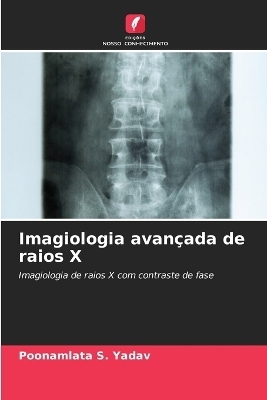 Imagiologia avan&ccedil;ada de raios X - Poonamlata S Yadav
