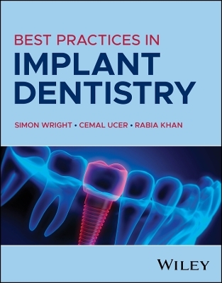 Best Practices in Implant Dentistry - 