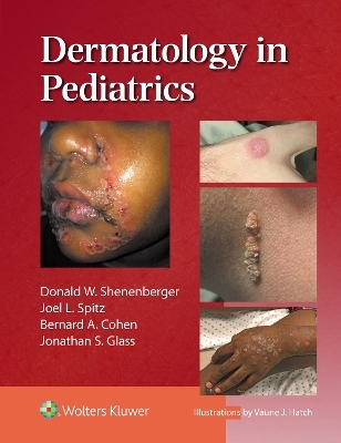 Dermatology in Pediatrics - Donald William Shenenberger, Joel L. Spitz