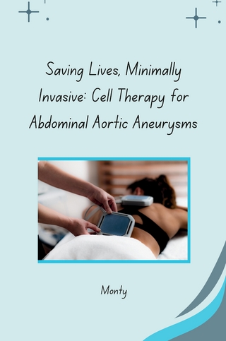 Saving Lives, Minimally Invasive: Cell Therapy for Abdominal Aortic Aneurysms