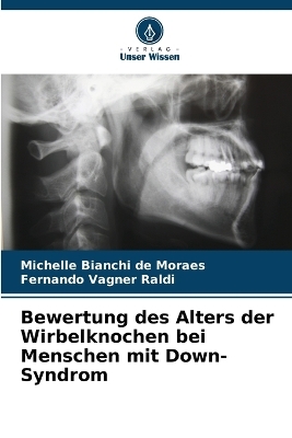 Bewertung des Alters der Wirbelknochen bei Menschen mit Down-Syndrom - Michelle Bianchi de Moraes, Fernando Vagner Raldi