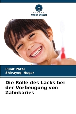 Die Rolle des Lacks bei der Vorbeugung von Zahnkaries - Punit Patel, Shivayogi Hugar