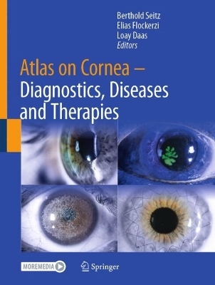 Atlas on Cornea - 