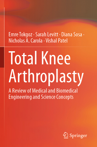 Total Knee Arthroplasty