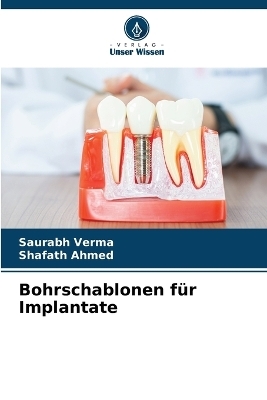 Bohrschablonen f&uuml;r Implantate - Saurabh Verma, Shafath Ahmed
