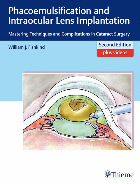 Phacoemulsification and Intraocular Lens Implantation - William J. Fishkind