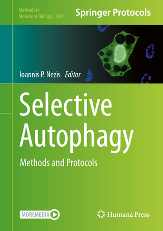 Selective Autophagy