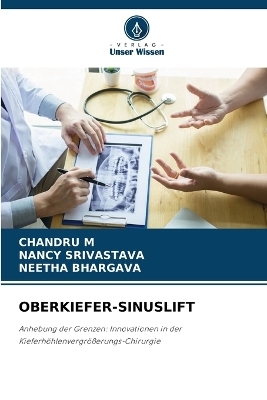 Oberkiefer-Sinuslift - CHANDRU M, Nancy Srivastava, NEETHA BHARGAVA