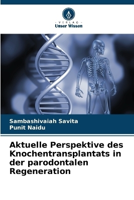 Aktuelle Perspektive des Knochentransplantats in der parodontalen Regeneration