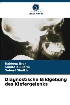 Diagnostische Bildgebung des Kiefergelenks - Rajdeep Brar, Sunita Kulkarni, Soheyl Sheikh