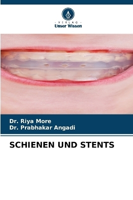 Schienen Und Stents - Dr Riya More, Dr Prabhakar Angadi