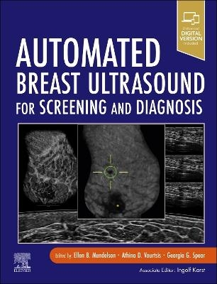 Automated Breast Ultrasound for Screening and Diagnosis