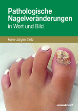 Pathologische Nagelver&auml;nderungen in Wort und Bild - Hans-J&uuml;rgen Tietz