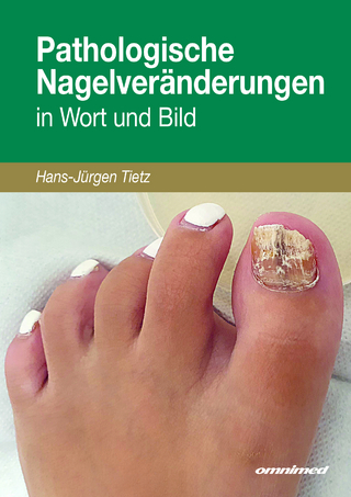Pathologische Nagelveränderungen in Wort und Bild