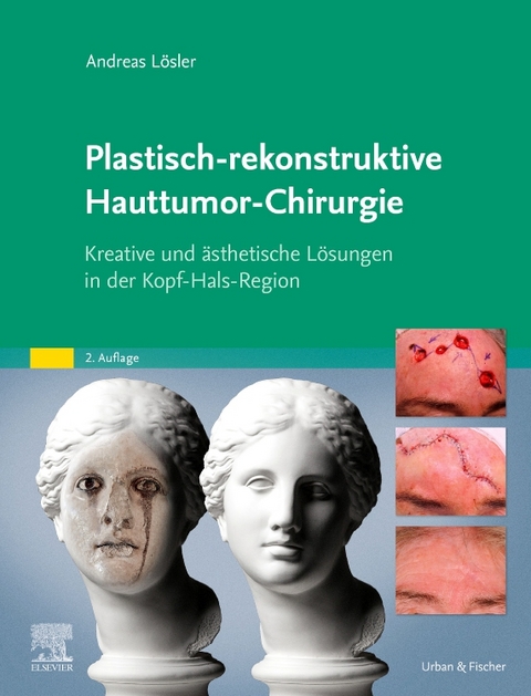 Plastisch-rekonstruktive Hauttumor-Chirurgie - Andreas L&ouml;sler