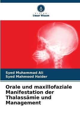 Orale und maxillofaziale Manifestation der Thalass&auml;mie und Management - Syed Muhammad Ali, Syed Mahmood Haider