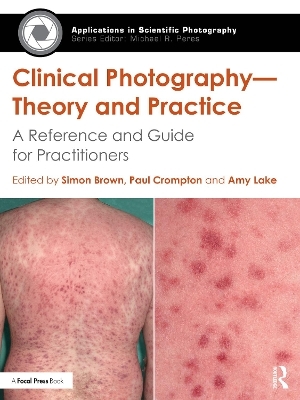 Clinical Photography &mdash; Theory and Practice - 