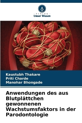Anwendungen des aus Blutpl&auml;ttchen gewonnenen Wachstumsfaktors in der Parodontologie - Kaustubh Thakare, Priti Charde, Manohar Bhongade