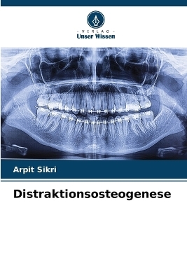 Distraktionsosteogenese - Arpit Sikri