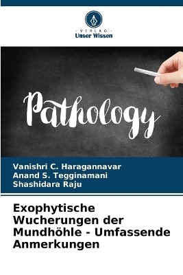 Exophytische Wucherungen der Mundh&ouml;hle - Umfassende Anmerkungen - Vanishri C Haragannavar, Anand S Tegginamani, Shashidara Raju