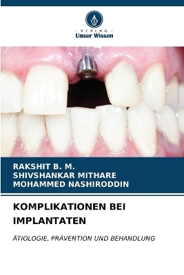 Komplikationen Bei Implantaten - Rakshit B M, Shivshankar Mithare, Mohammed Nashiroddin