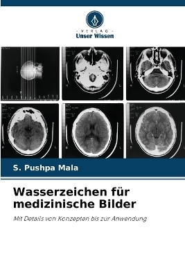 Wasserzeichen f&uuml;r medizinische Bilder - S Pushpa Mala
