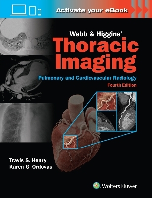 Webb & Higgins Thoracic Imaging: Print + eBook with Multimedia - Travis Scott Henry, KAREN GOMES ORDOVAS