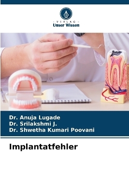 Implantatfehler - Dr Anuja Lugade, Dr Srilakshmi J, Dr Shwetha Kumari Poovani