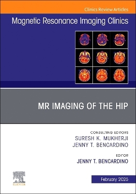 MR Imaging of the Hip, An Issue of Magnetic Resonance Imaging Clinics of North America - 