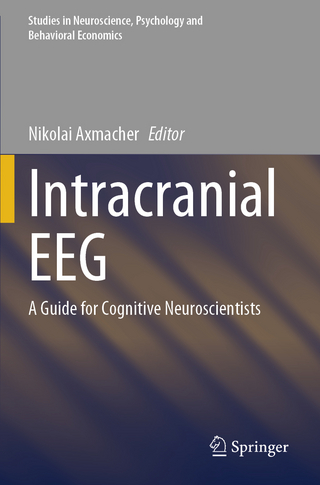 Intracranial EEG