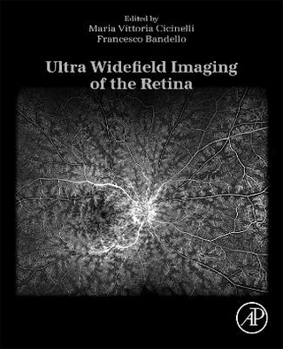 Ultra Widefield Imaging of the Retina