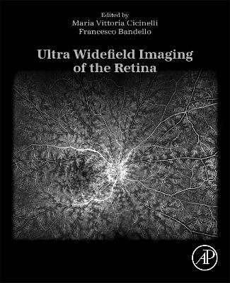 Ultra Widefield Imaging of the Retina - 