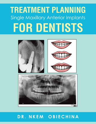 Treatment Planning Single Maxillary Anterior Implants for Dentists