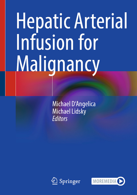 Hepatic Arterial Infusion for Malignancy - 