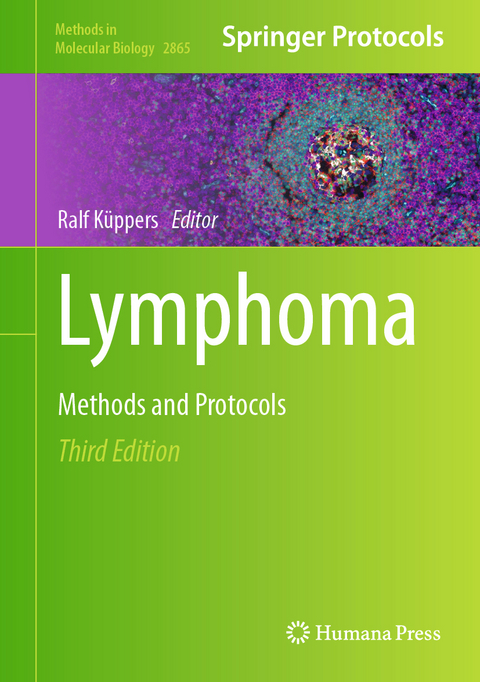 Lymphoma - 